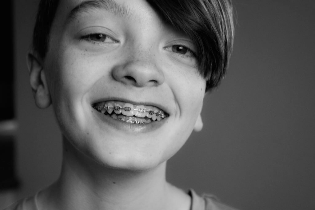 Boy wearing braces, smiling